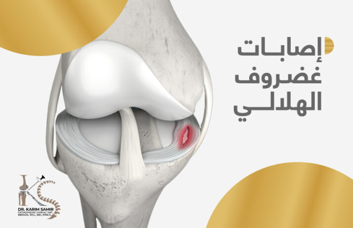 علاج اصابات غضروف الهلالى