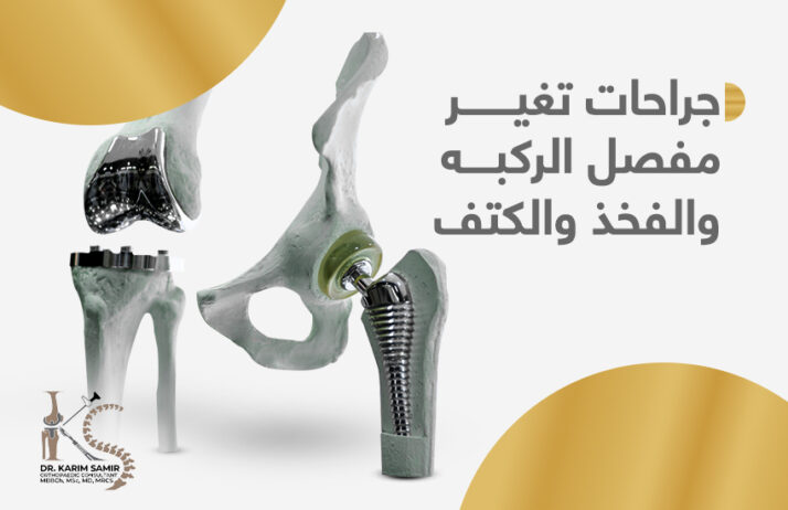 سعر عملية تغيير مفصل الحوض