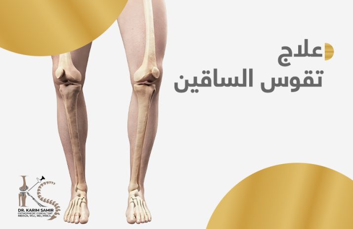 جراحات استعدال تقوس الساقين