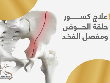 علاج-كسور-حلقه-الحوض-و-حق-مفصل-فخد
