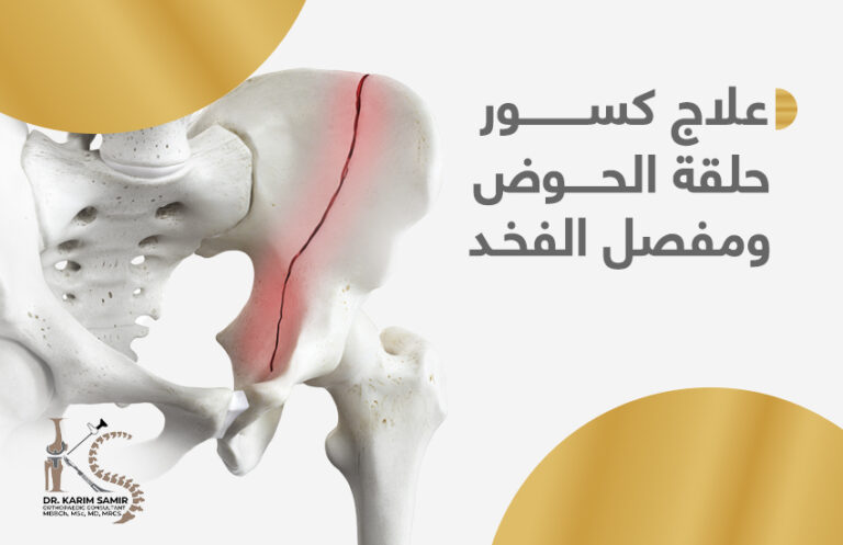 عملية تغيير مفصل الحوض