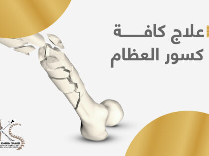 علاج كسور العظام