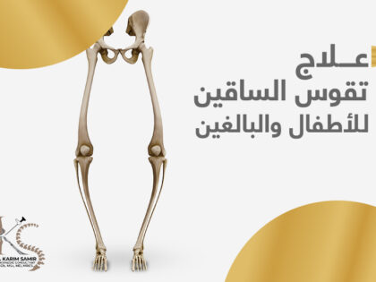 علاج-تقوس-الساقين-للاطفال-و-البالغين