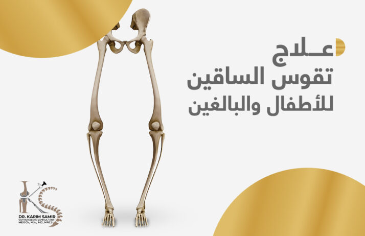 علاج تقوس الساقين للأطفال
