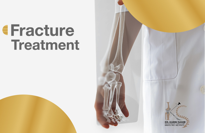 bone Fracture Treatment