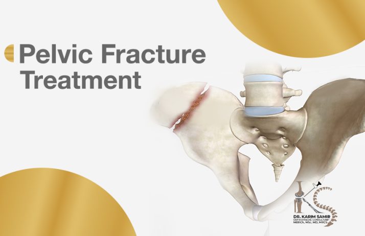 Pelvic Fracture Treatment