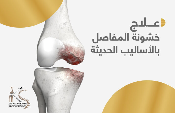 علاج خشونة المفاصل