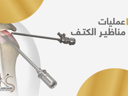 -عمليات-مناظير-الكتف