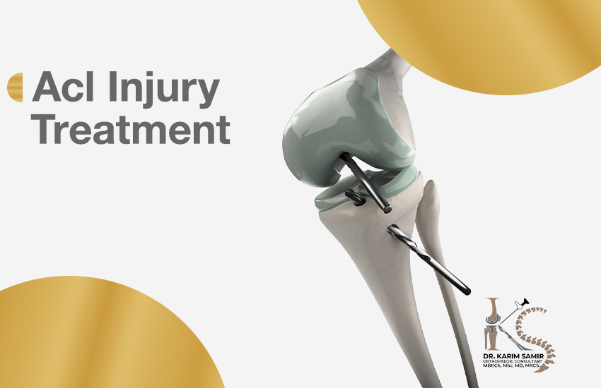 ACL Reconstruction