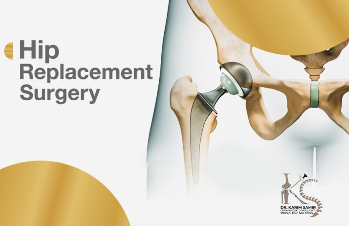 Hip replacement surgeries
