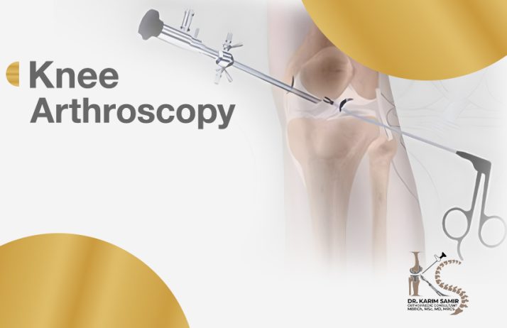 Arthroscopic knee operations