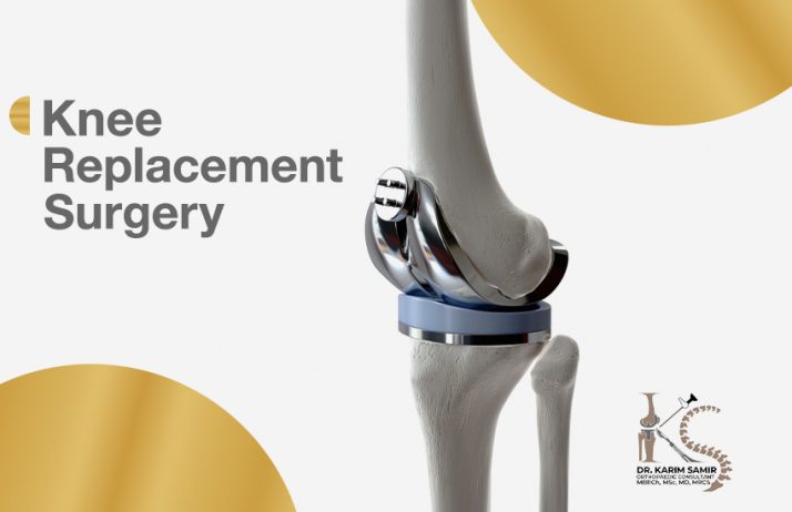 Knee replacement surgeries