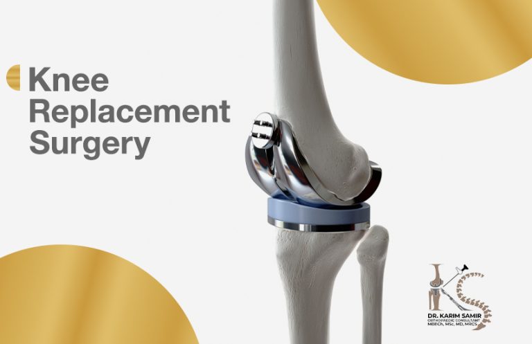 Knee replacement surgeries