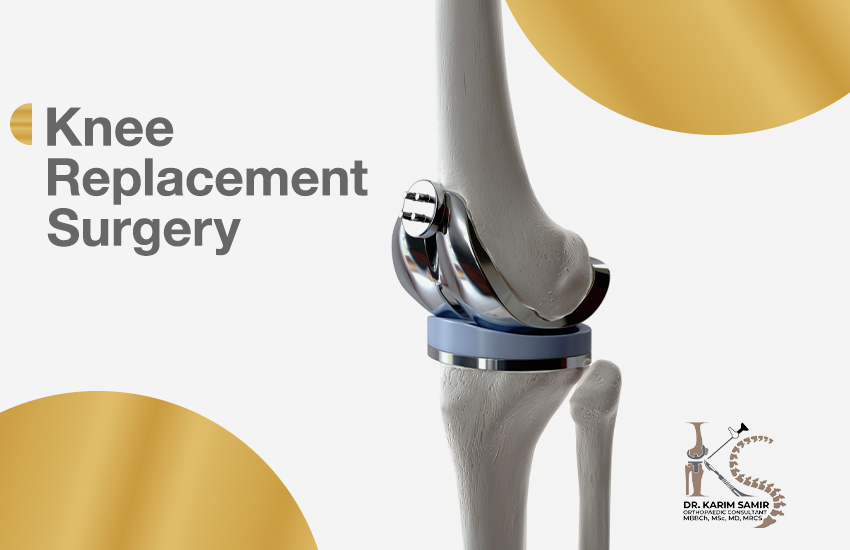 Knee replacement surgeries