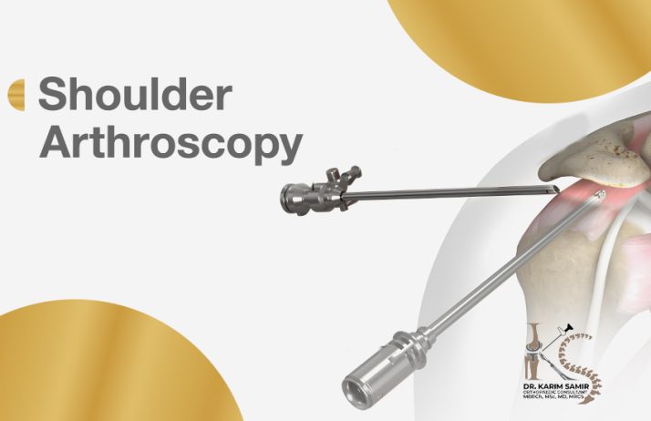 Shoulder arthroscopic operations