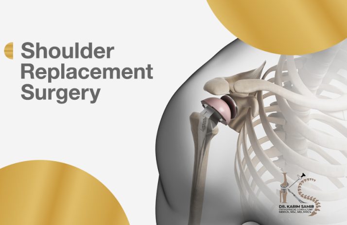 shoulder replacement surgery
