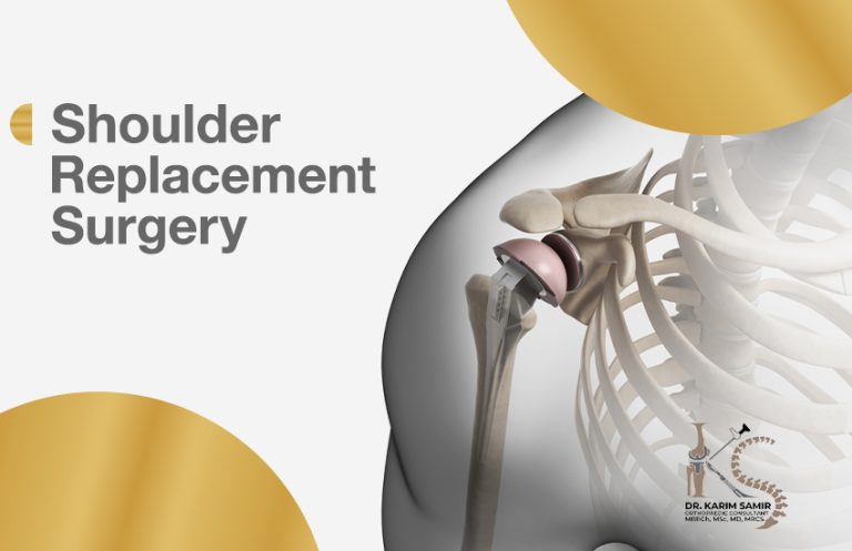 shoulder replacement surgery
