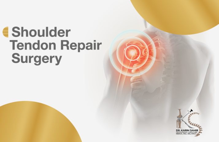 shoulder tendon reconstruction