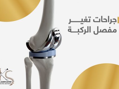 جراحات تغيير مفصل الركبة