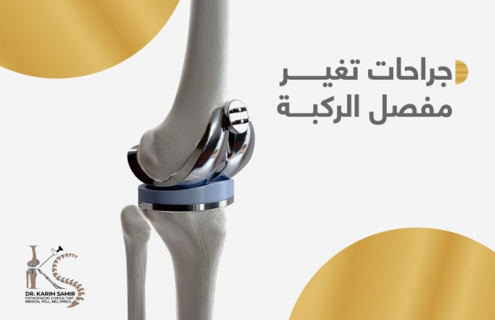 جراحات تغيير مفصل الركبة