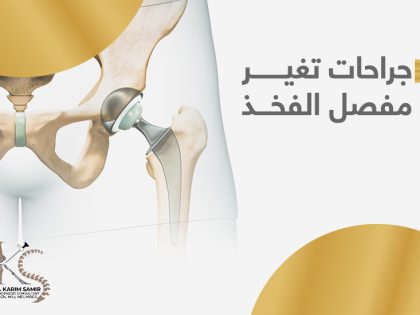 جراحات-تغيير-مفصل-الفخذ