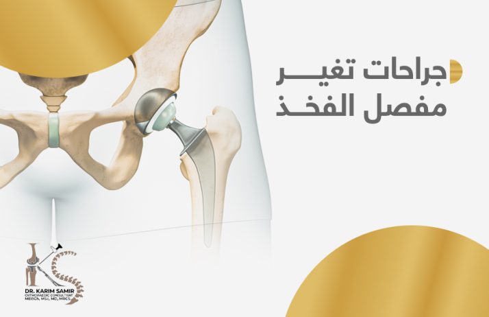 جراحات تغيير مفصل الفخذ