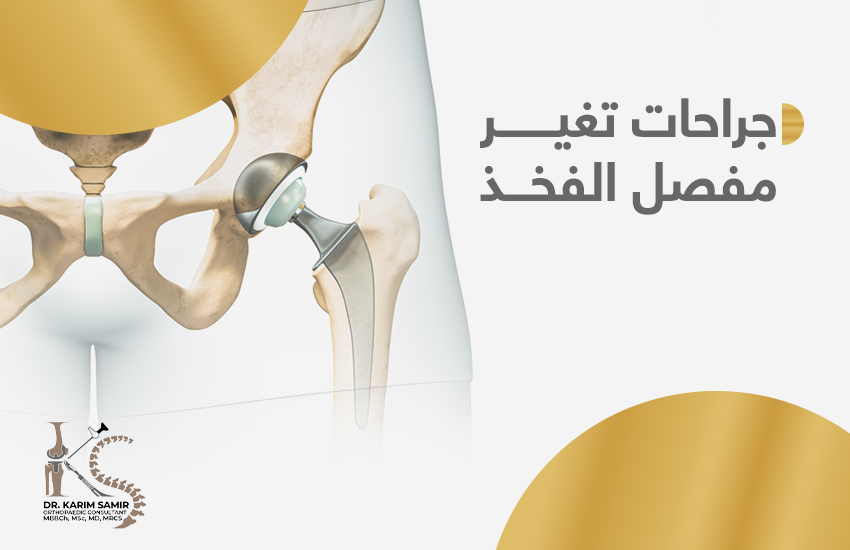 جراحات تغيير مفصل الفخذ