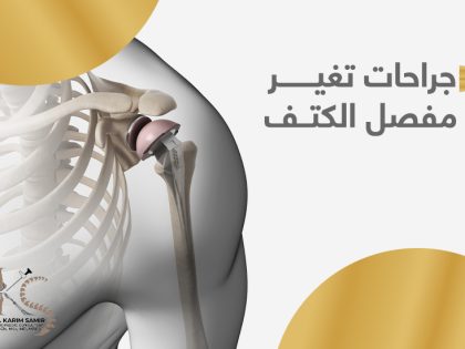 جراحات-تغيير-مفصل-الكتف
