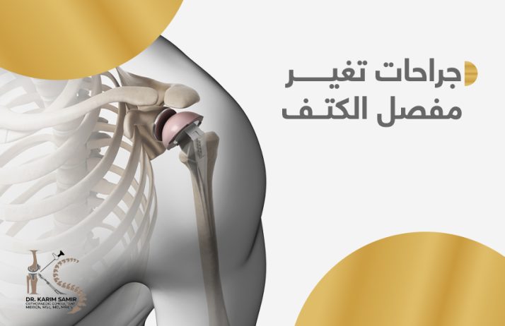 جراحات تغيير مفصل الكتف