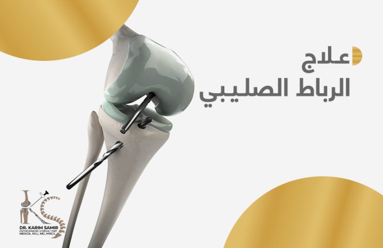 أفضل دكتور رباط صليبي في مصر