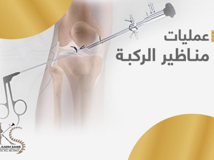 عمليات-مناظير-الركبة
