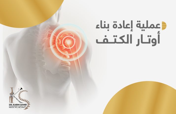 عملية إعادة بناء تمزق أوتار الكتف