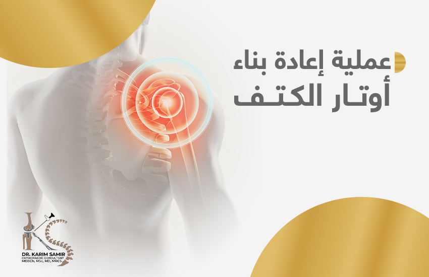 عملية إعادة بناء تمزق أوتار الكتف