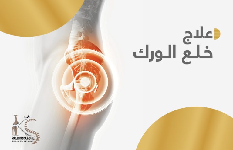 علاج خلع الورك