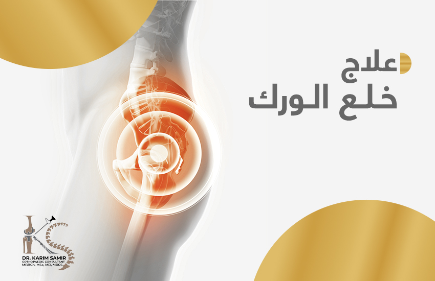 علاج خلع الورك الولادي