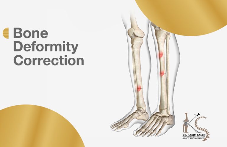 deformity correction
