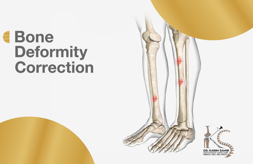 Bone Deformity Correction