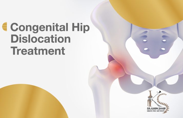 Developmental Dysplasia of the Hip (DDH)