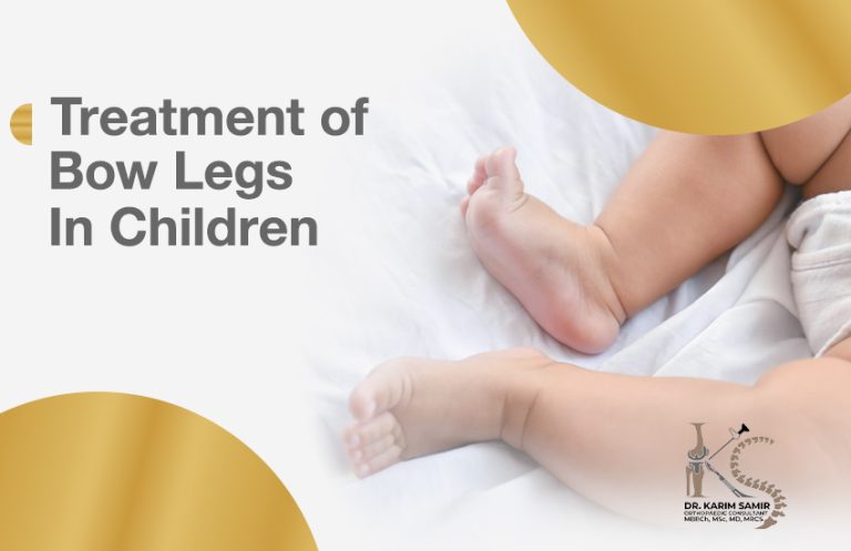 Treatment of Bow Legs in Children