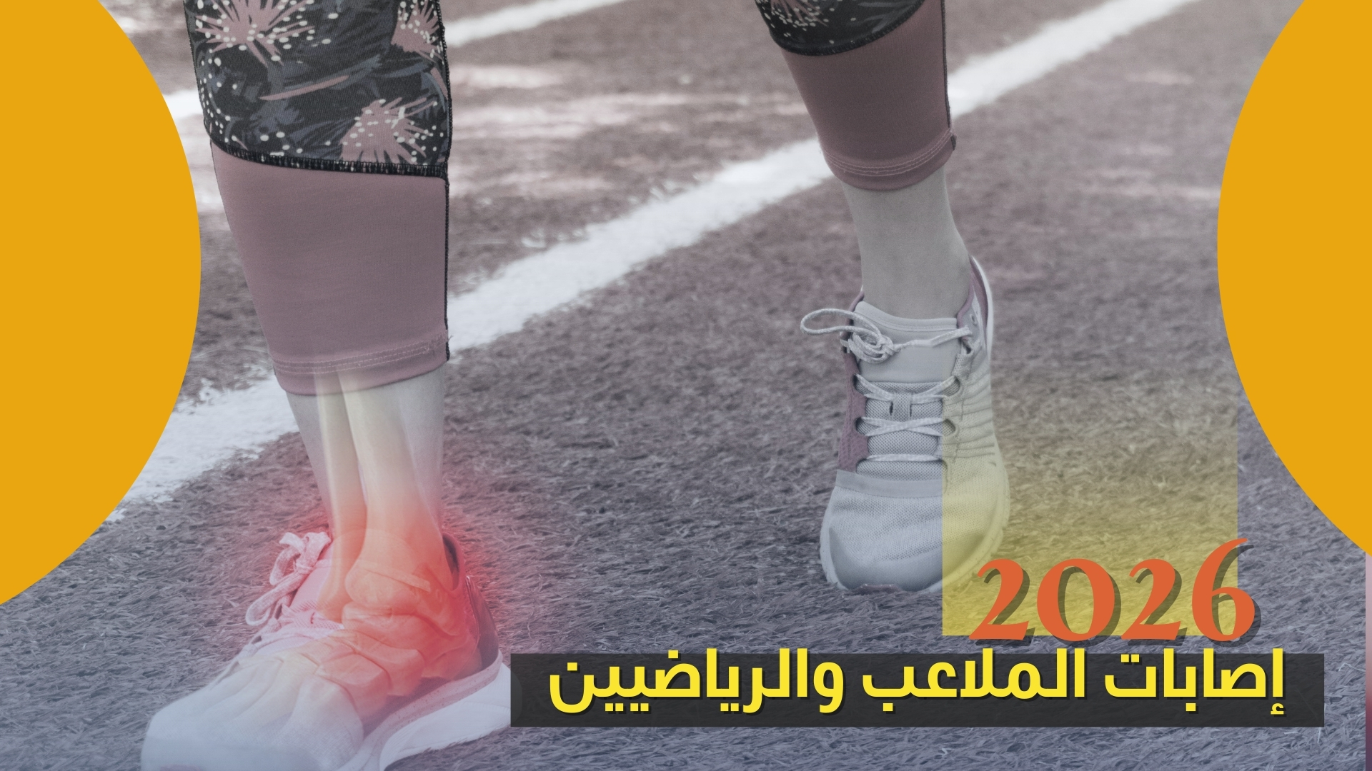 أنواع حالات العظام الشائعة التي يعالجها افضل دكتور عظام في المقطم